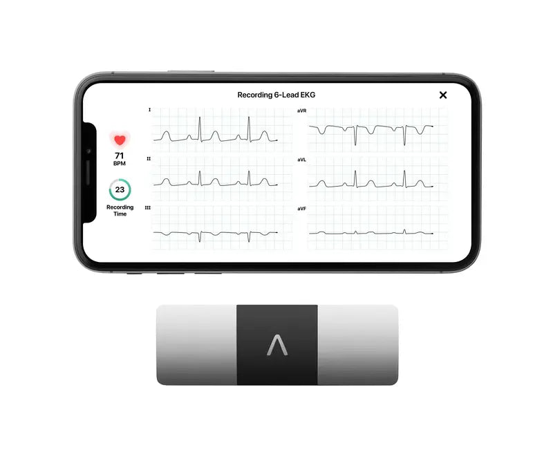 KardiaMobile 6L Personal EKG Monitor – FDA-Cleared, Compatible with Most Smartphones